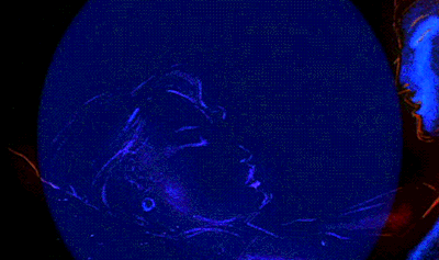 ꧁「♡ نمک در زخم ♡」꧂